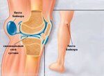 Покраснело колено и болит что это может быть